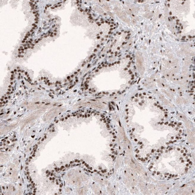 METTL14 Antibody in Immunohistochemistry (IHC)