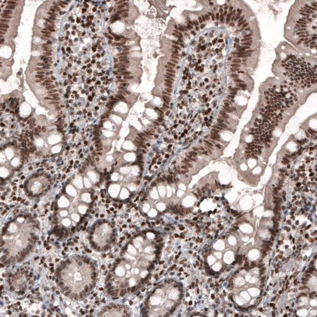 SMCHD1 Antibody in Immunohistochemistry (IHC)