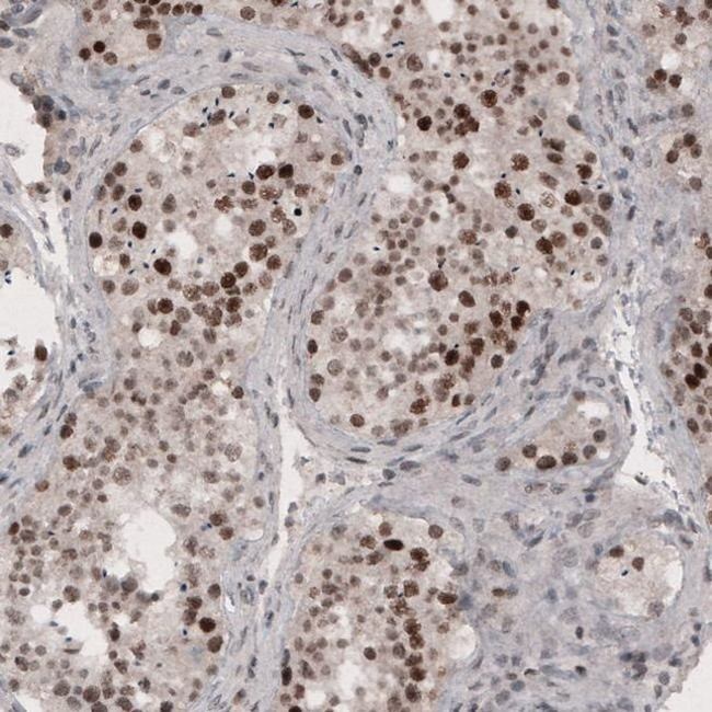 SMCHD1 Antibody in Immunohistochemistry (IHC)