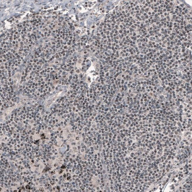 SMCHD1 Antibody in Immunohistochemistry (IHC)