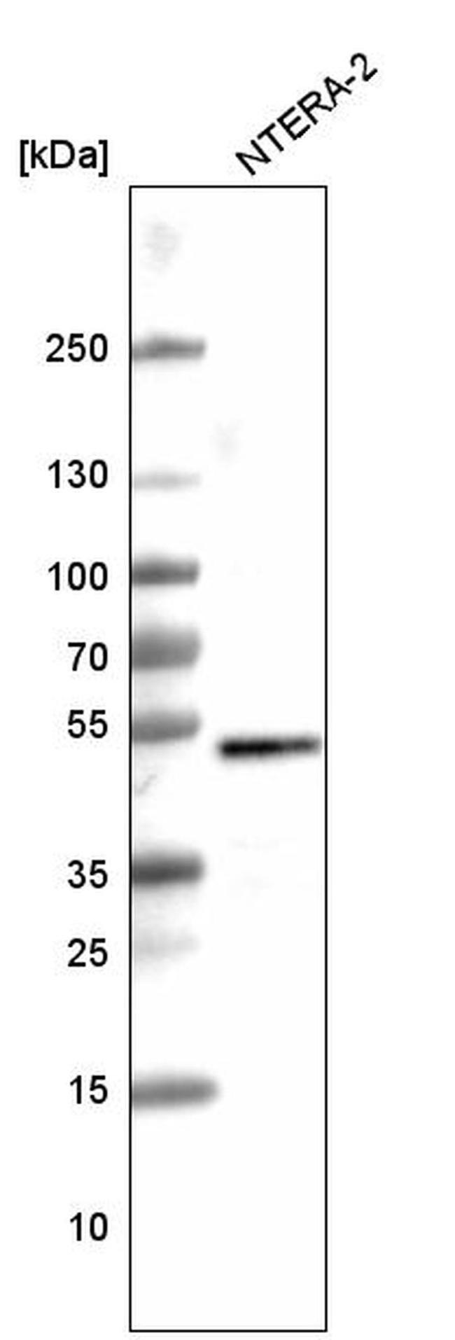 SOX3 Antibody in Western Blot (WB)