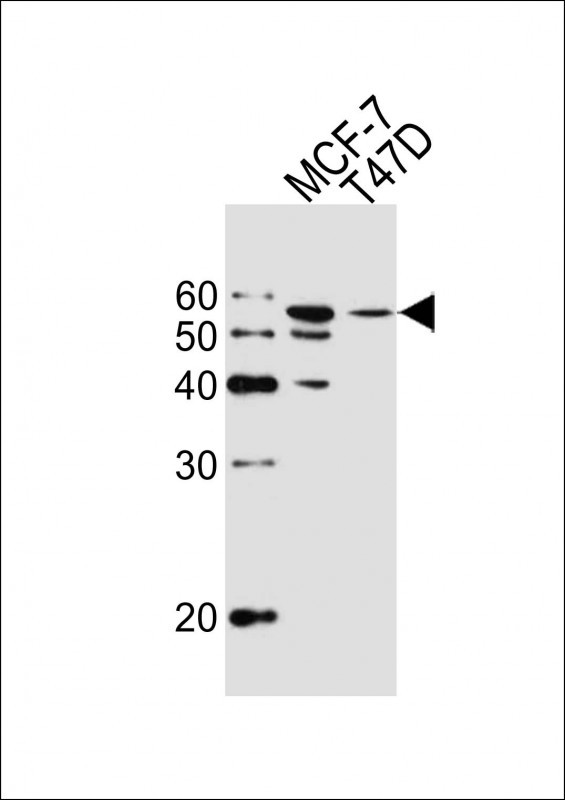 ALDH6A1 Antibody in Western Blot (WB)