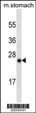 LYPD6B Antibody in Western Blot (WB)