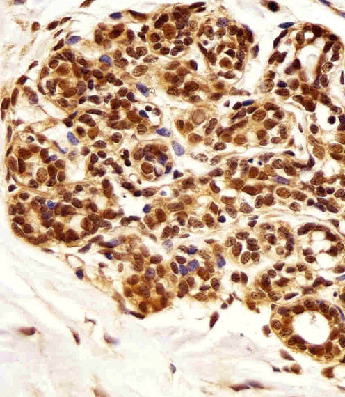 PIN1 Antibody in Immunohistochemistry (Paraffin) (IHC (P))