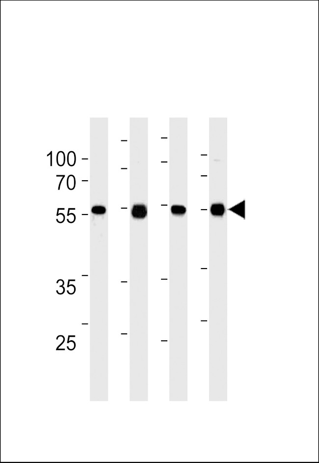 TPTE2 Antibody in Western Blot (WB)