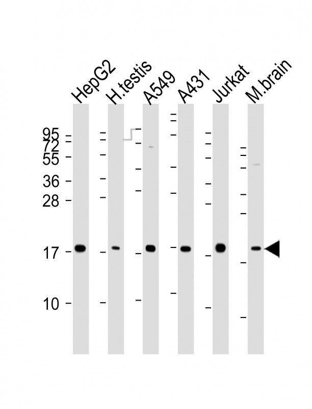 EEF1E1 Antibody in Western Blot (WB)