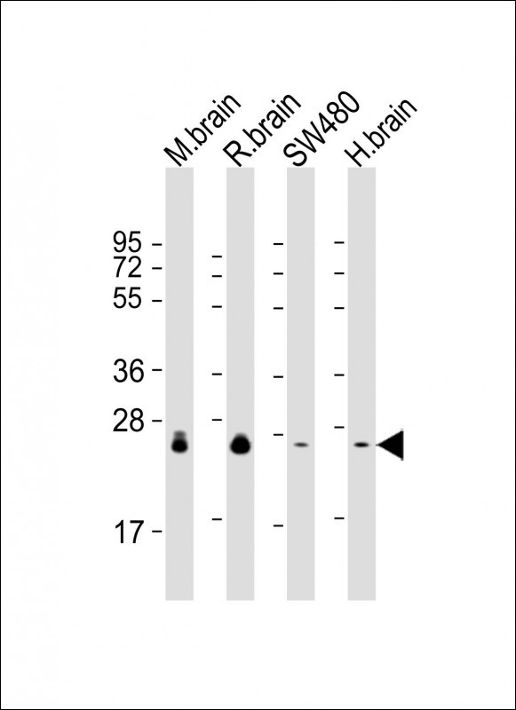 RAB3B Antibody in Western Blot (WB)