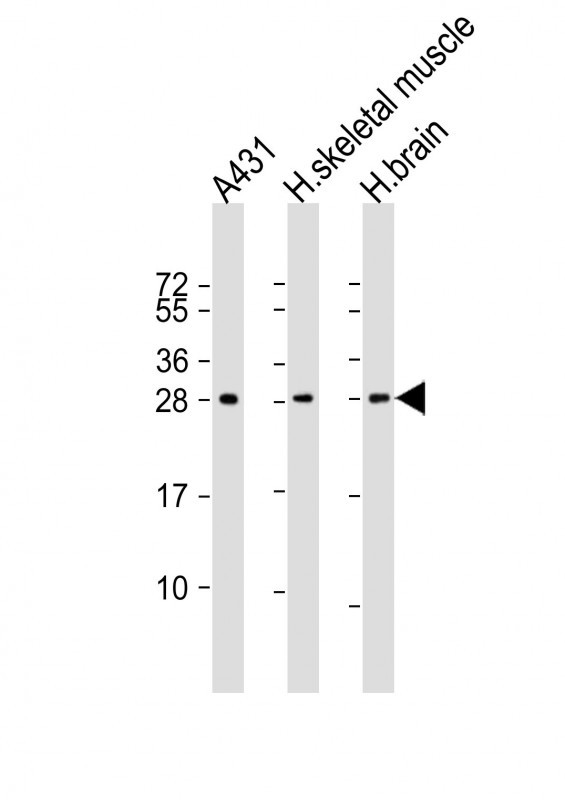 DENR Antibody in Western Blot (WB)