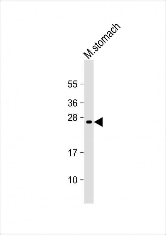 RAB27B Antibody in Western Blot (WB)