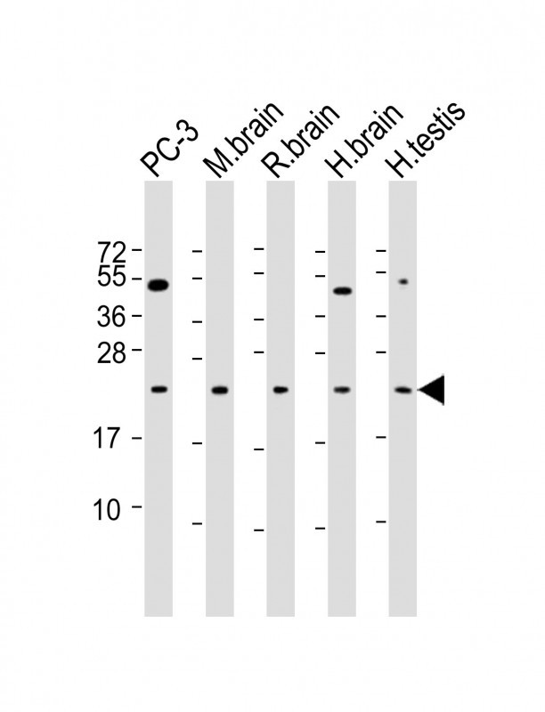 RAB18 Antibody in Western Blot (WB)