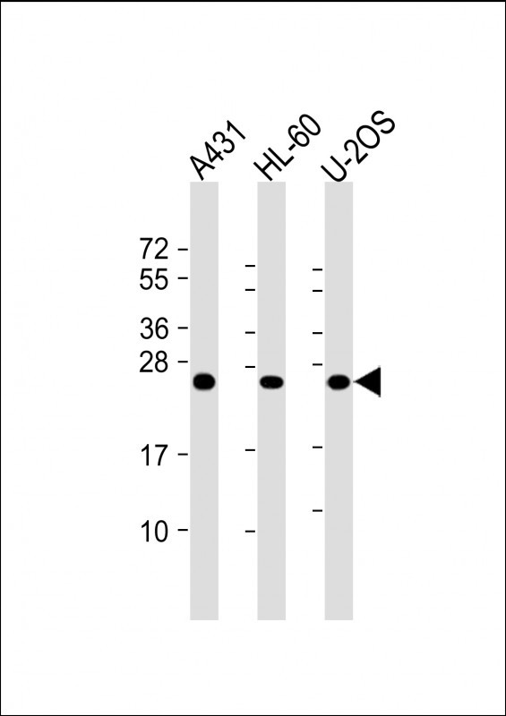 RAB5C Antibody in Western Blot (WB)