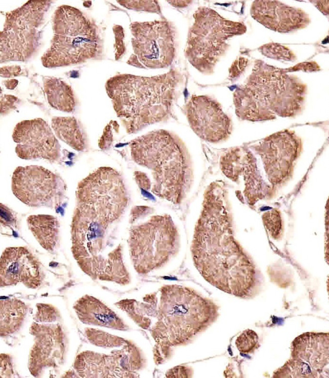 MYO18B Antibody in Immunohistochemistry (Paraffin) (IHC (P))