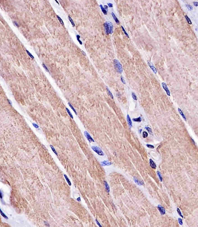 MYO18B Antibody in Immunohistochemistry (Paraffin) (IHC (P))