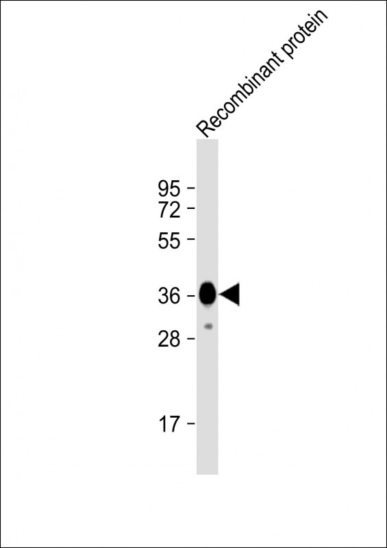 MYO18B Antibody in Western Blot (WB)