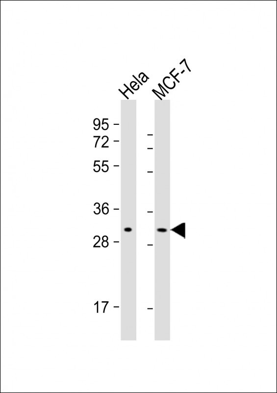 RAB20 Antibody in Western Blot (WB)