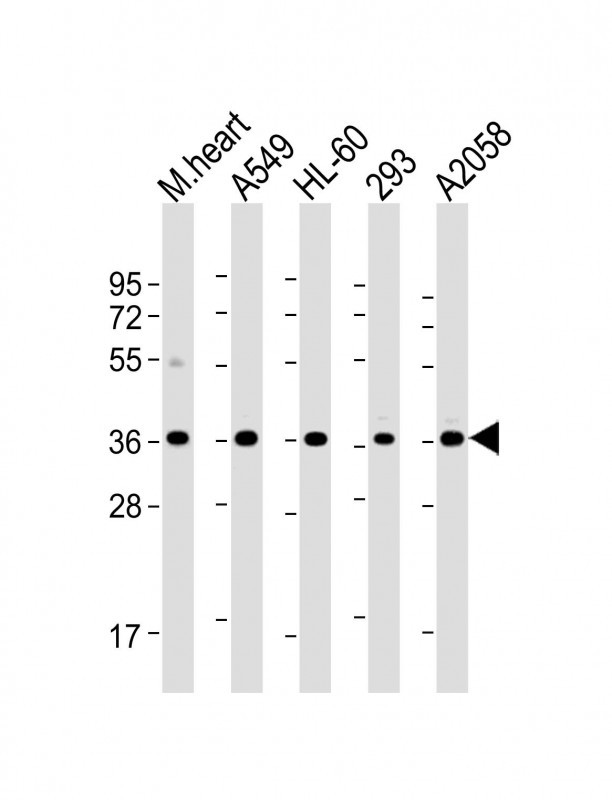 WBP2 Antibody in Western Blot (WB)