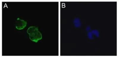 SCN5A Antibody in Immunocytochemistry (ICC/IF)