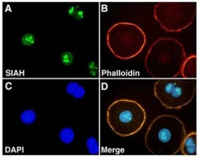 SIAH2 Antibody in Immunocytochemistry (ICC/IF)