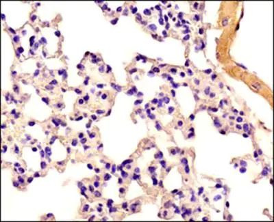 SCAF11 Antibody in Immunohistochemistry (Paraffin) (IHC (P))