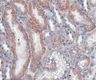 VLDLR Antibody in Immunohistochemistry (IHC)