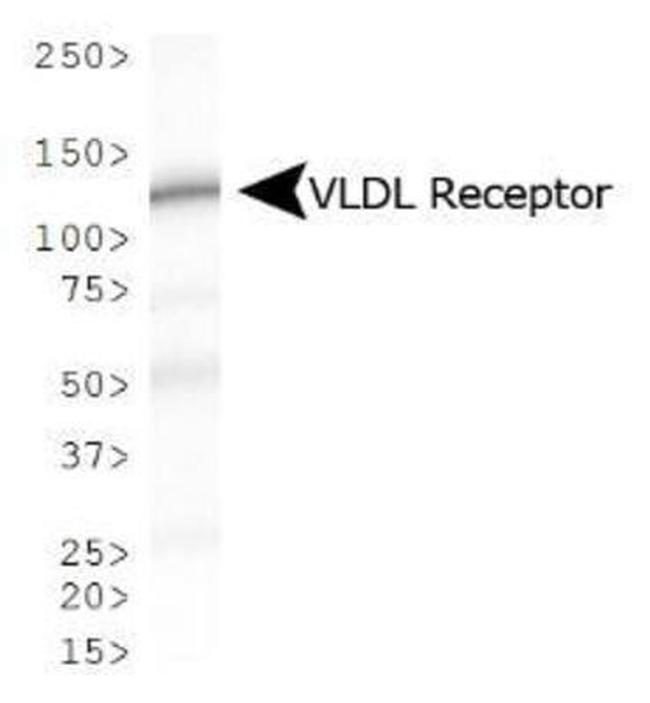 VLDLR Antibody in Western Blot (WB)