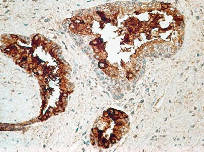 TCCR Antibody in Immunohistochemistry (Paraffin) (IHC (P))