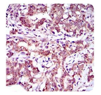 ABCG5 Antibody in Immunohistochemistry (Paraffin) (IHC (P))