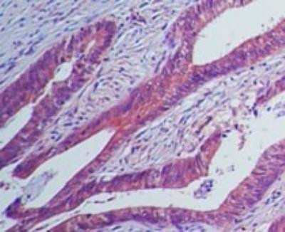 IL23R Antibody in Immunohistochemistry (Paraffin) (IHC (P))