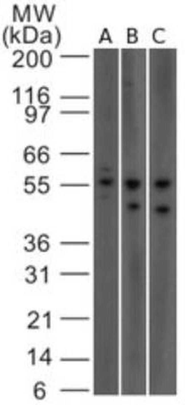 IL23R Antibody in Western Blot (WB)