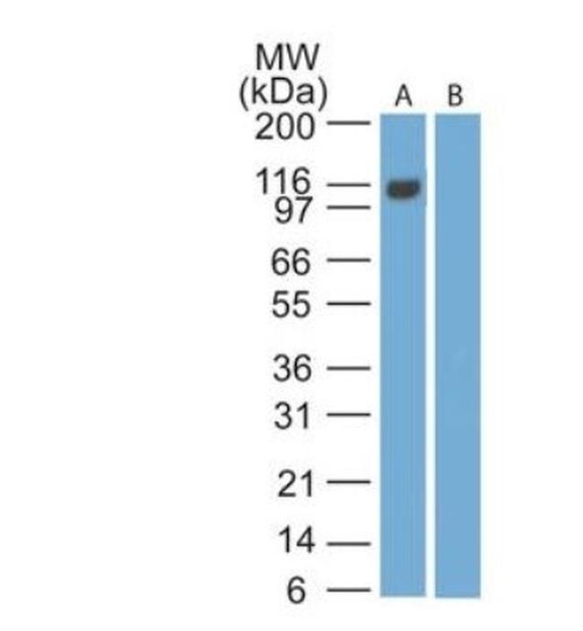 EBI3 Antibody in Western Blot (WB)