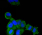 ALPL Antibody in Immunocytochemistry (ICC/IF)