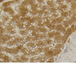 ALPL Antibody in Immunohistochemistry (Paraffin) (IHC (P))