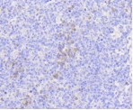 MLKL Antibody in Immunohistochemistry (Paraffin) (IHC (P))