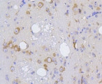 IRF1 Antibody in Immunohistochemistry (Paraffin) (IHC (P))