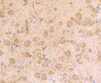 IFNAR1 Antibody in Immunohistochemistry (Paraffin) (IHC (P))