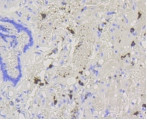 ABCG1 Antibody in Immunohistochemistry (Paraffin) (IHC (P))