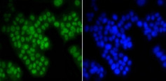 ASH2L Antibody in Immunocytochemistry (ICC/IF)