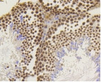 ASH2L Antibody in Immunohistochemistry (Paraffin) (IHC (P))