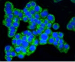 TOMM20 Antibody in Immunocytochemistry (ICC/IF)