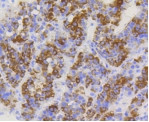 TOMM20 Antibody in Immunohistochemistry (Paraffin) (IHC (P))