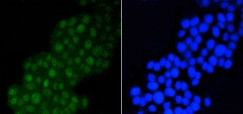 DGCR8 Antibody in Immunocytochemistry (ICC/IF)