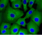 ATP Citrate Lyase Antibody in Immunocytochemistry (ICC/IF)