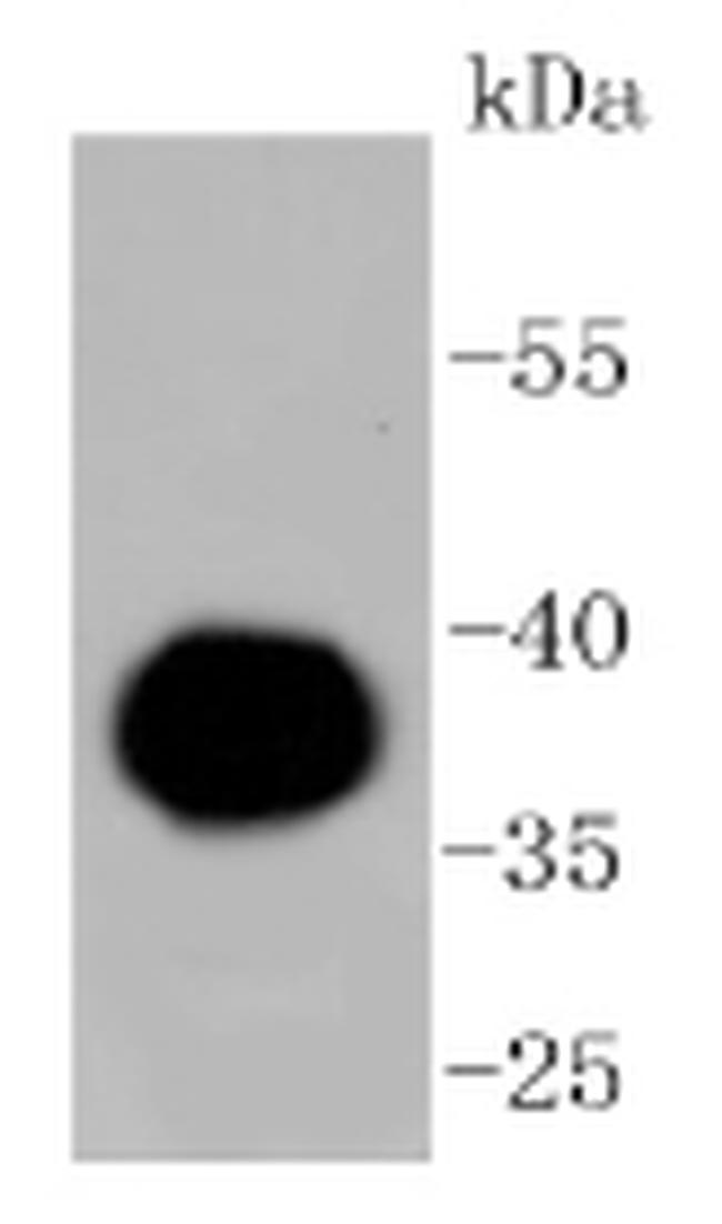 Human IgG4 Antibody in Western Blot (WB)