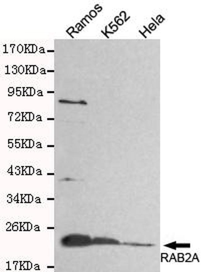 RAB2A Antibody in Western Blot (WB)