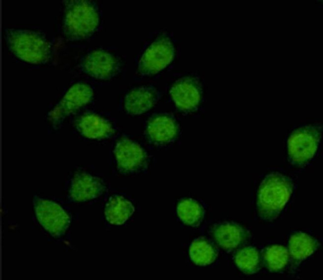 TBL1X Antibody in Immunocytochemistry (ICC/IF)