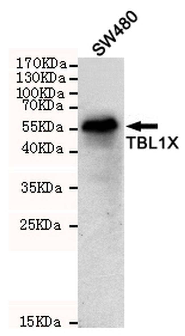 TBL1X Antibody in Western Blot (WB)