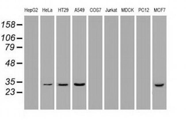 Hex Antibody in Western Blot (WB)