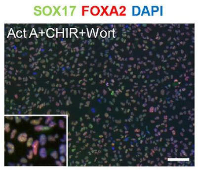 SOX17 Antibody in Immunocytochemistry (ICC/IF)