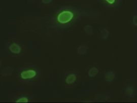 ICAD Antibody in Immunocytochemistry (ICC/IF)