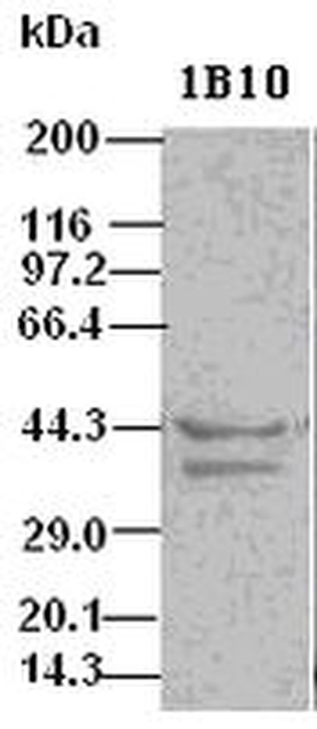 ICAD Antibody in Western Blot (WB)